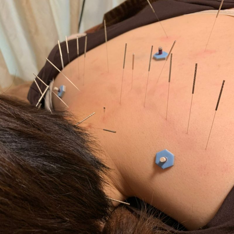 A133FF3A-6178-4685-9E9B-A4DBA5681BB2