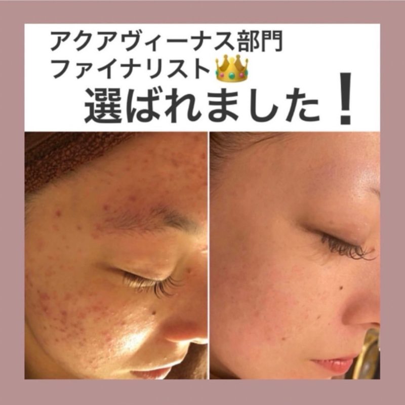 20DF0DB3-98F5-46A1-9FDC-BE23F9946F0A