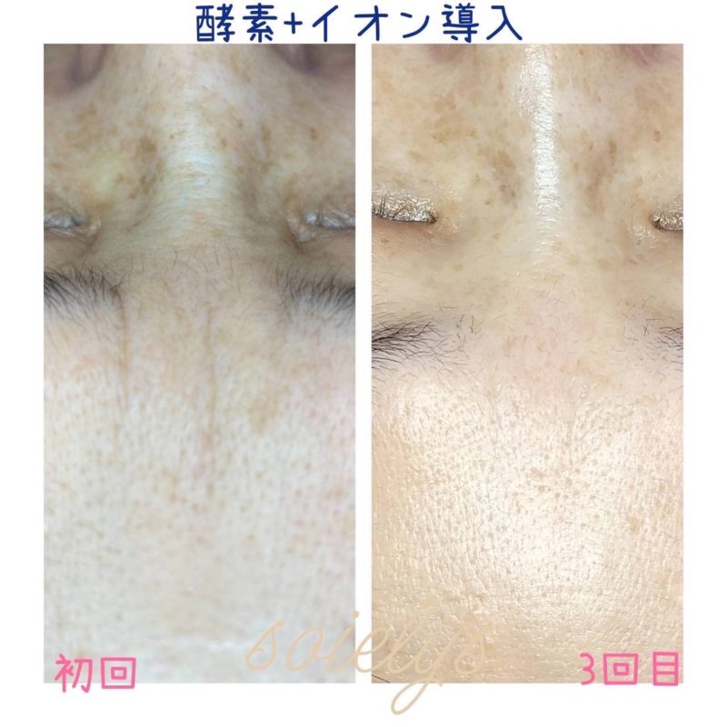 BDDA237D-81B3-4366-83D9-0BEED7AC140F