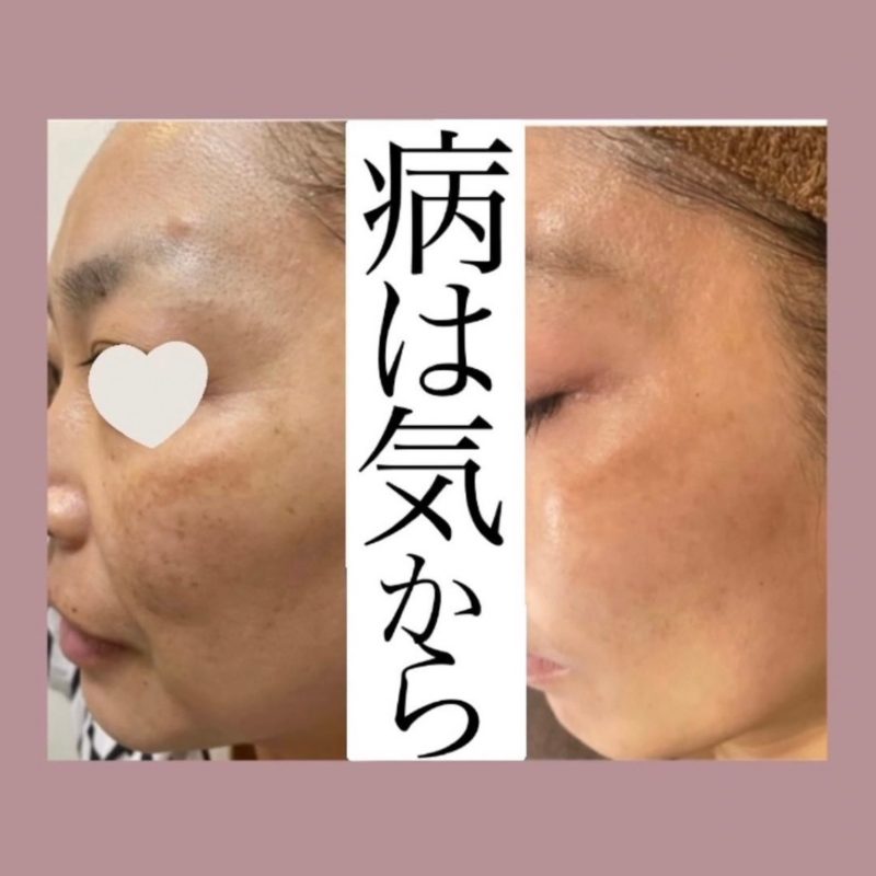 DBACEBC1-D6C4-4017-A36E-CB8CE8D52B52