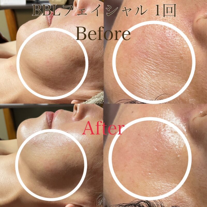 B490A79D-9D78-4437-ABEF-861543BFE339