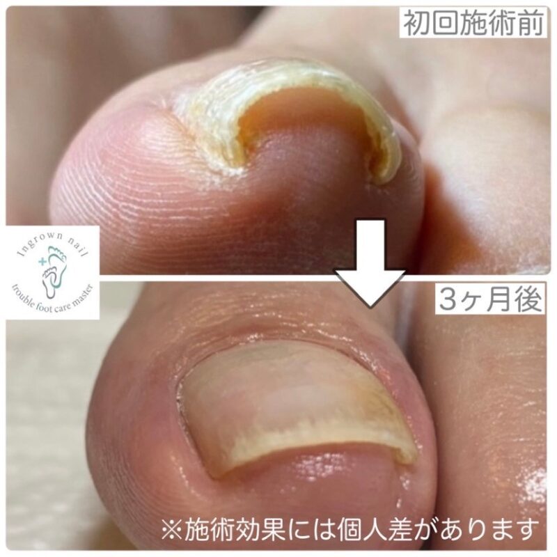 EE973B0B-D682-45F3-AB18-101618CDF0FA