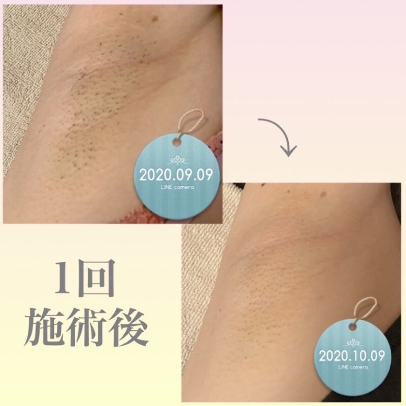 line_oa_chat_231004_145505