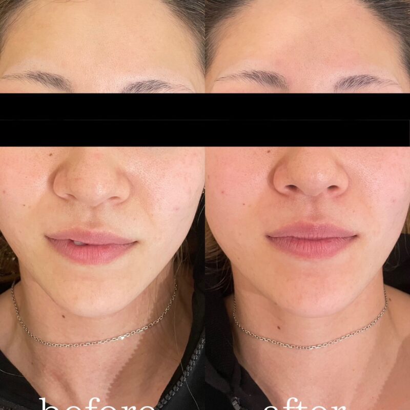 51CAC889-4FDE-427B-B820-3BFAEAEA4E54