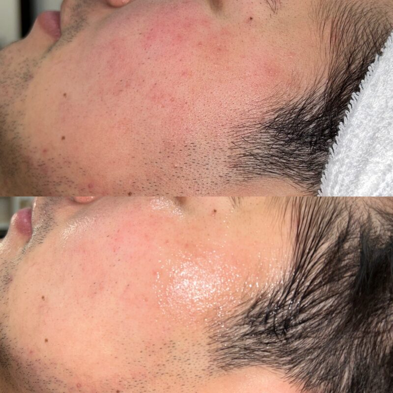 CA6F1B29-DC32-45FE-A3E2-290EBBC68941