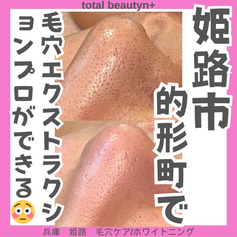 line_oa_chat_240308_120239