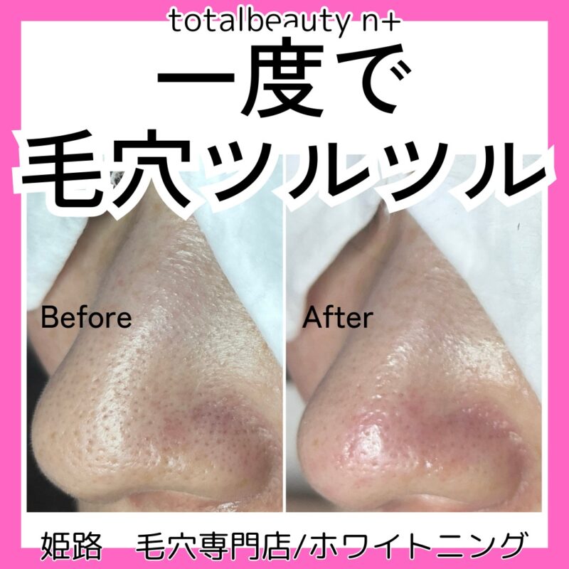 line_oa_chat_240308_120241