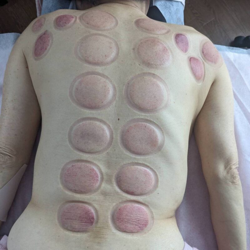 エステハウスOhana6スライド