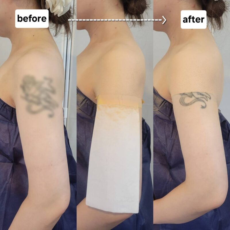 line_oa_chat_240522_232032