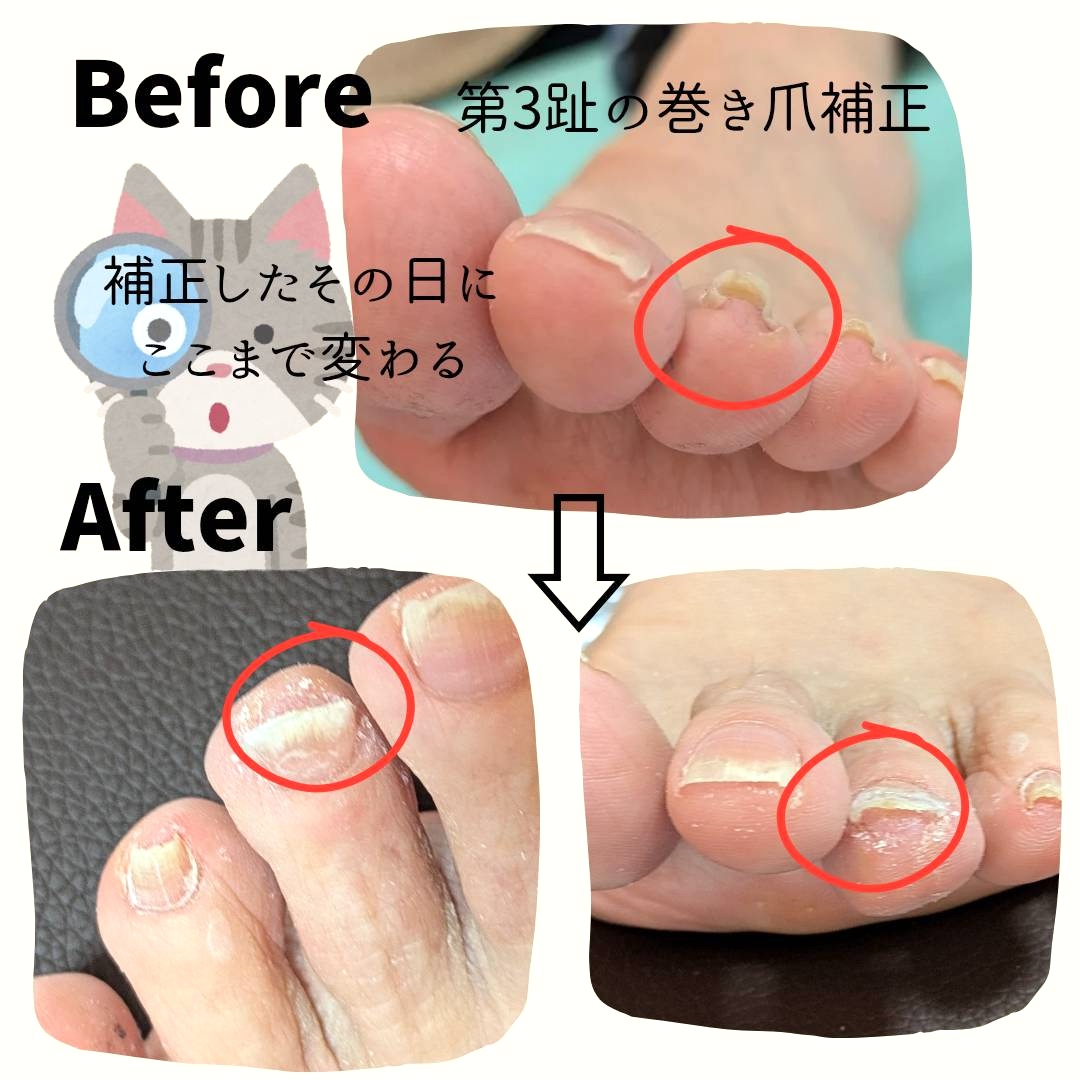 フットケア　早い者勝ち！！ 楽天市場】【福袋セール10%OFF】【フットメジ公式】 足用 泡ソープ 4本